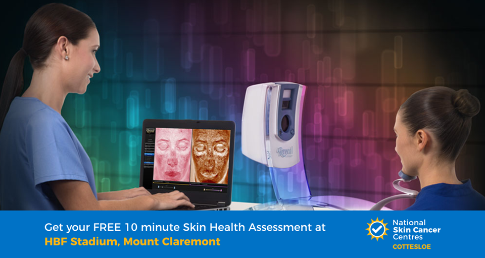 Skin Health assessment at HBF Stadium ad